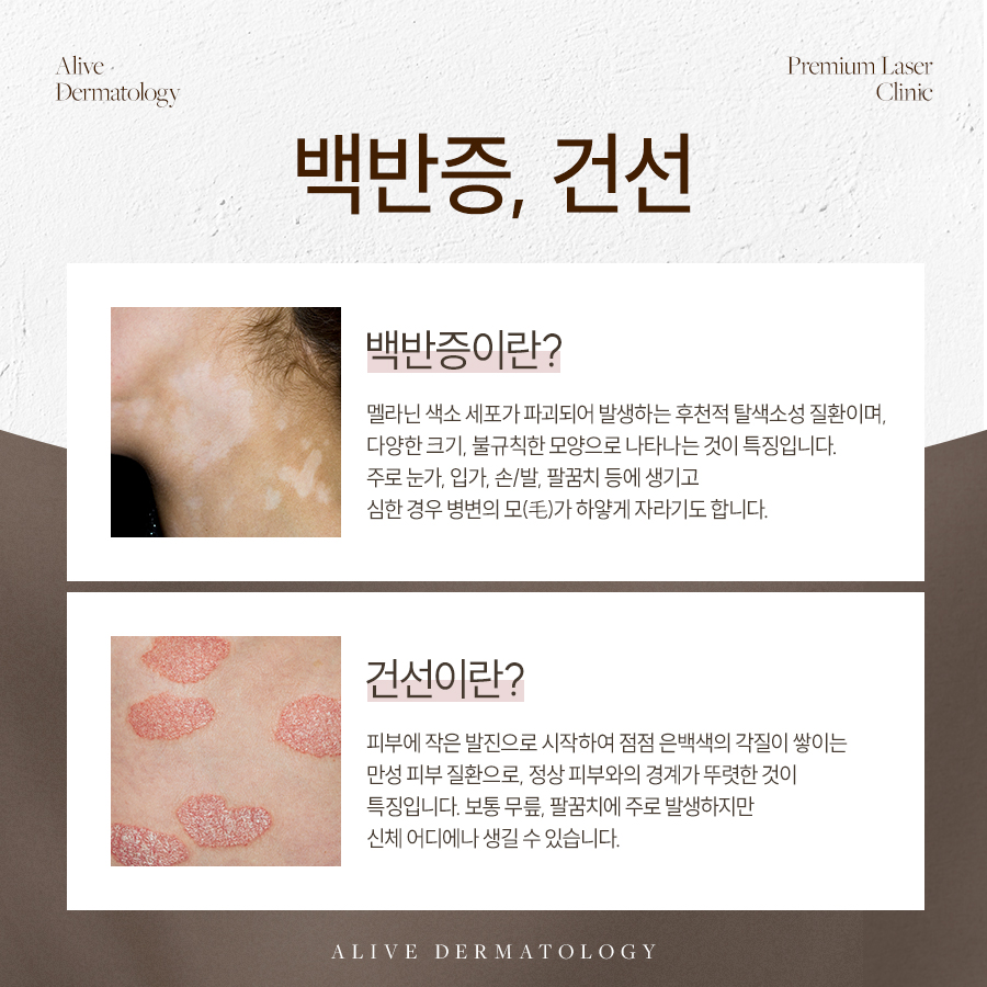 원베일리상가피부과추천 적절한 관리로