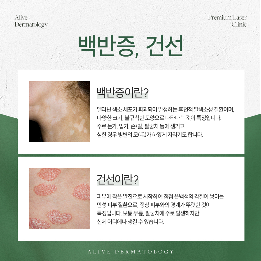 고속터미널역건선치료 관리해야
