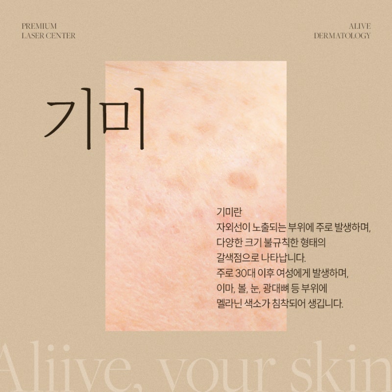 반포레이저토닝잘하는곳 고민된다면? 사진 2