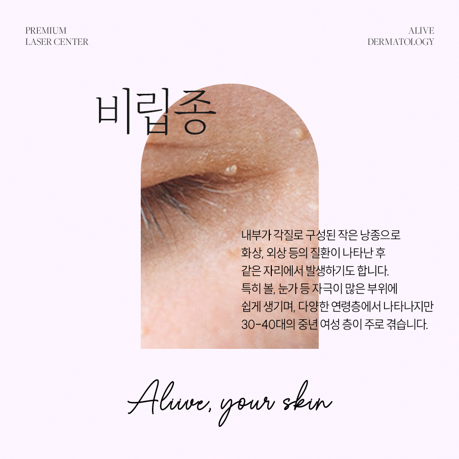 서초편평사마귀 흉터없이 사진 3