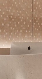 용산백반증 더 심해지기 전에 치료하세요 사진 21