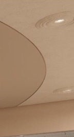 용산백반증 더 심해지기 전에 치료하세요 사진 17