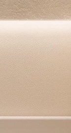 동작피부과 리쥬란힐러로 수분충전 사진 25