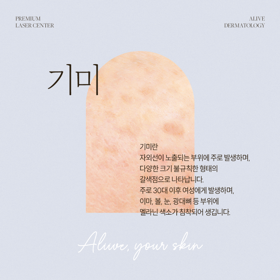 신반포역피부과 깨끗하고 맑은 피부를 위한 레이저토닝