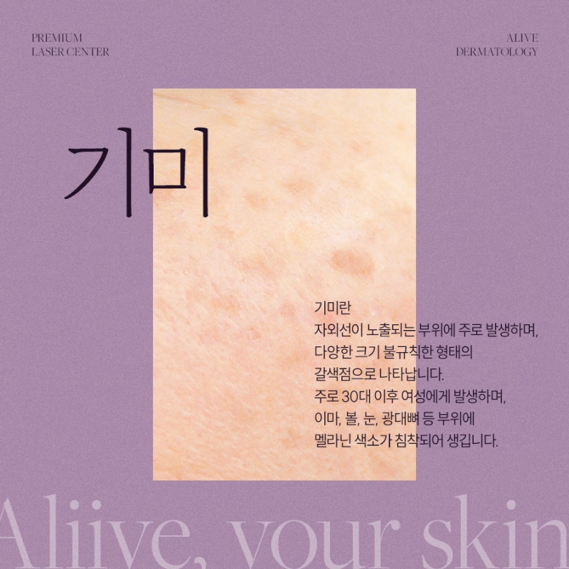 서초레이저토닝 병변에 맞게 진행