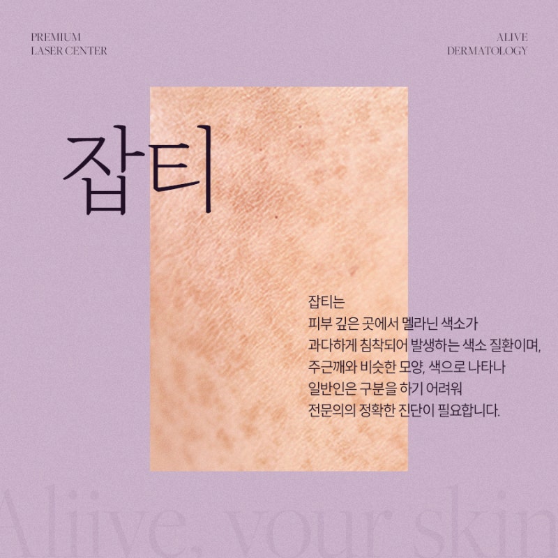 서초레이저토닝 병변에 맞게 진행 사진 3