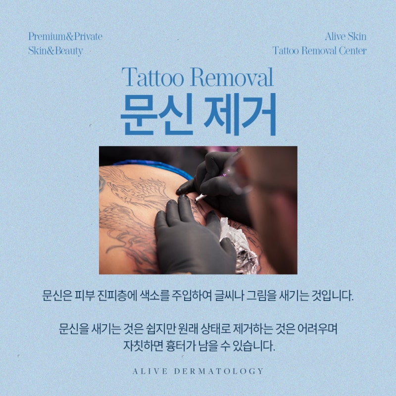고속터미널문신제거 피코웨이로 받아야 하는 이유는?