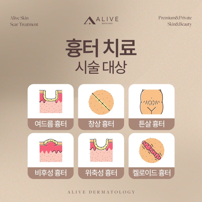 동작흉터치료, 고려하고 있다면? 사진 4