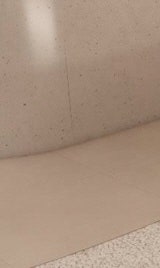 신반포역건선, 더 심해지기 전에 치료해야 사진 31