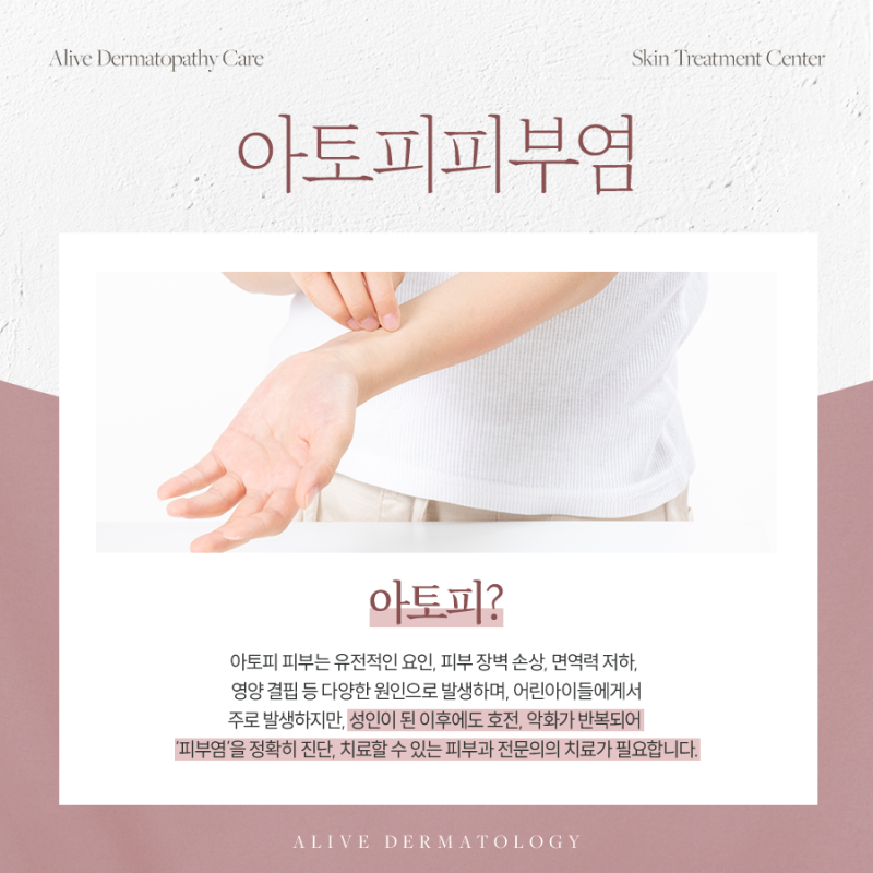 방배동피부과, 아토피 초반에 제대로 잡아 놓아야