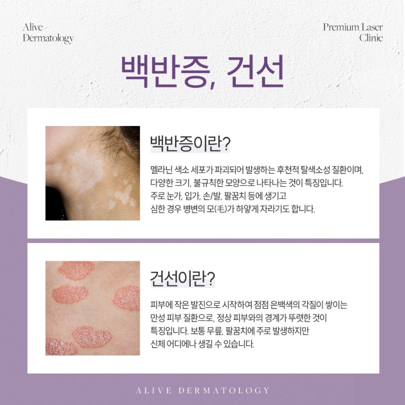 고속터미널역건선, 해결하려면