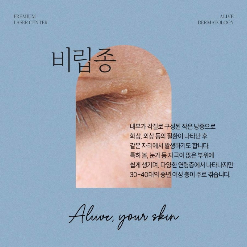 고속터미널역사마귀, 초반에 치료해야 사진 3