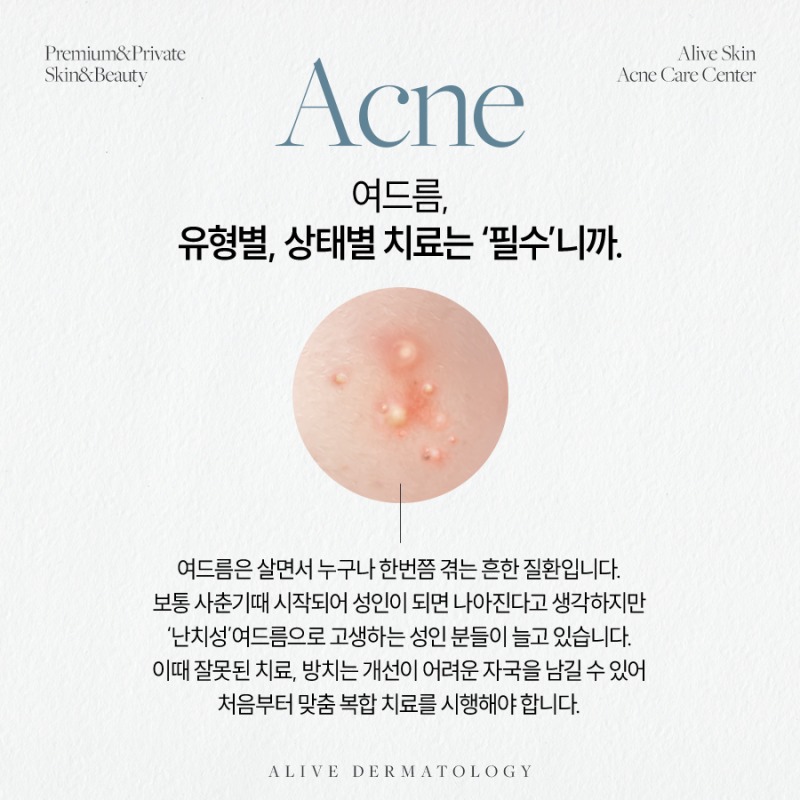 동작여드름흉터, 관리부터 치료까지