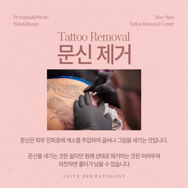 신반포역피부과, 문신을 제거하고 싶다면?
