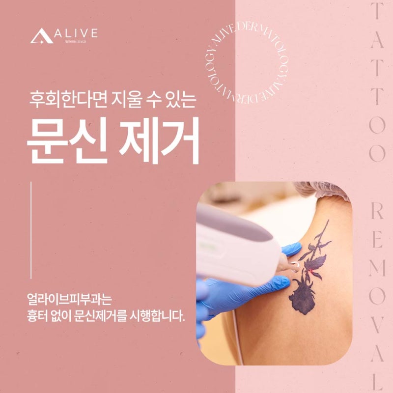 신반포역피부과, 문신을 제거하고 싶다면?