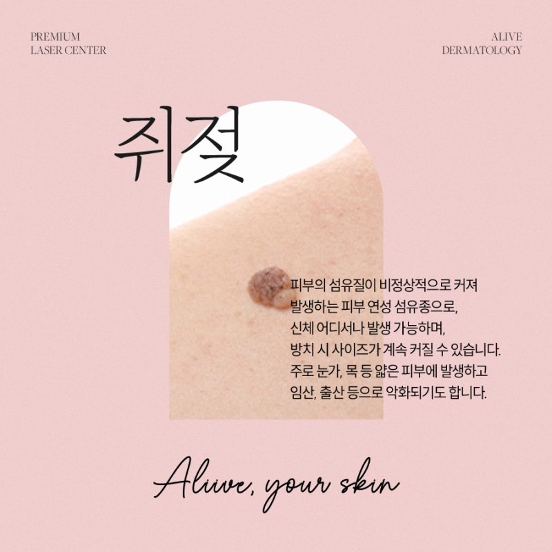 고속터미널역사마귀 치료가 필요하다면? 사진 4