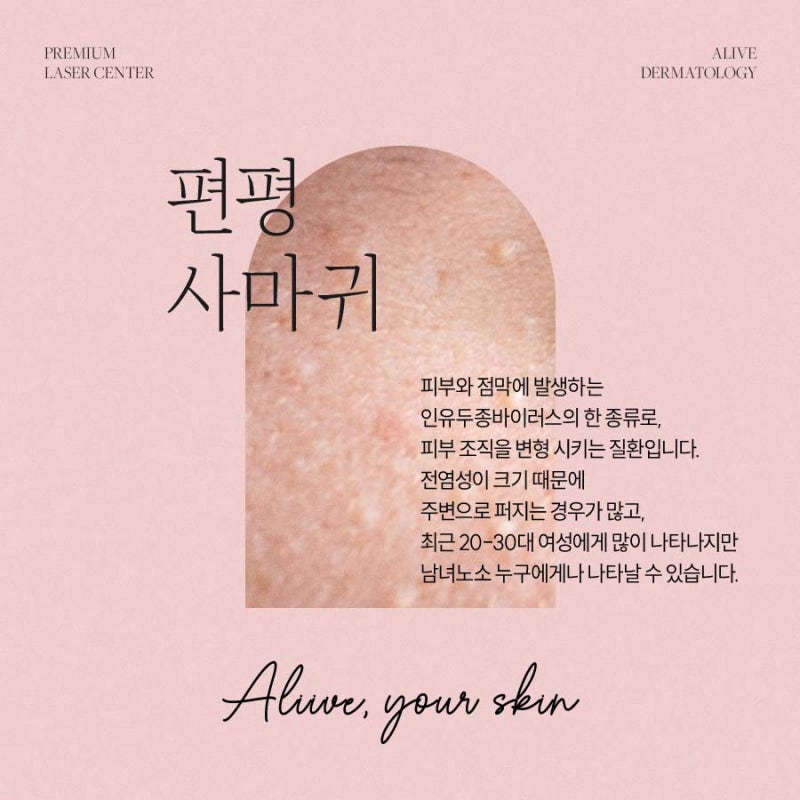 고속터미널역사마귀 치료가 필요하다면? 사진 3