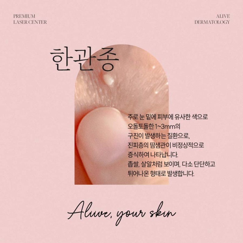 고속터미널역사마귀 치료가 필요하다면? 사진 5