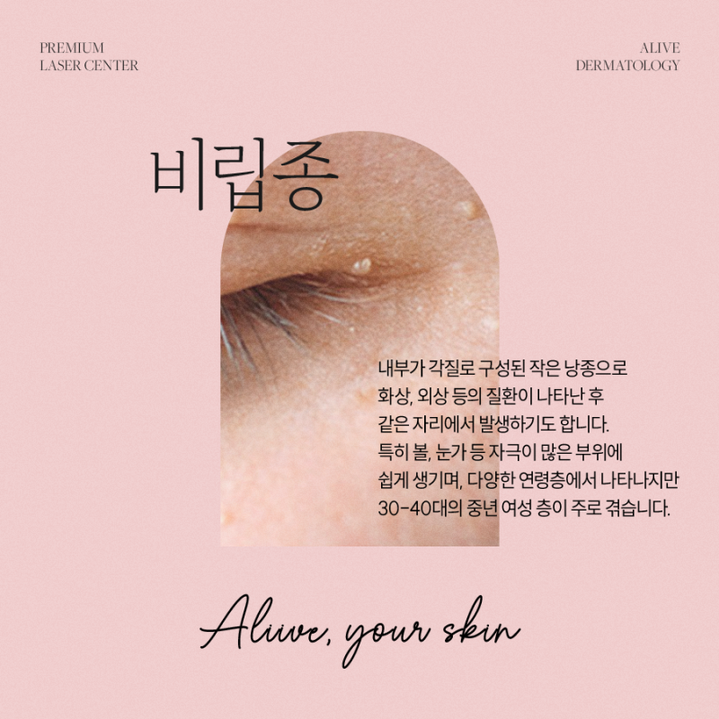 고속터미널역사마귀 치료가 필요하다면? 사진 6