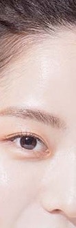 서초동스킨바이브, 궁금하다면? 사진 22