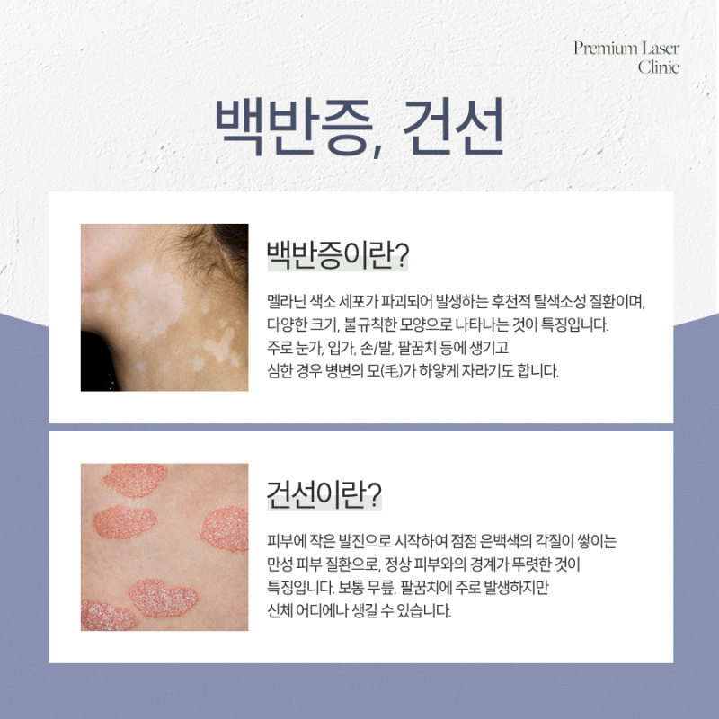 서초동백반증, 대처 방안에 대해