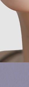손상된 피부를 되돌리는 방법, 반포동리쥬란힐러 사진 24