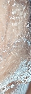 신반포역리쥬란힐러, 속부터 건강한 피부를 원한다면? 사진 20