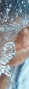 신반포역리쥬란힐러, 속부터 건강한 피부를 원한다면? 사진 21