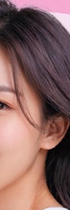 동안의 비결, 반포온다리프팅 사진 19