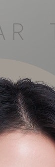 반포동흉터치료, 단순한 미용이 아닌 회복의 시작 사진 11