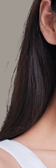 반포동흉터치료, 단순한 미용이 아닌 회복의 시작 사진 18