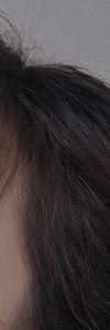 고속터미널여드름, 왜 계속 생길까? 유형부터 관리법까지 사진 12