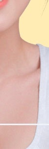 고속터미널역피부과, 자극 없이 정돈하는 온다리프팅 사진 29