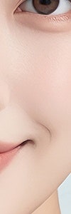 방배리쥬란힐러로 시작하는 피부 밸런스 관리 사진 19