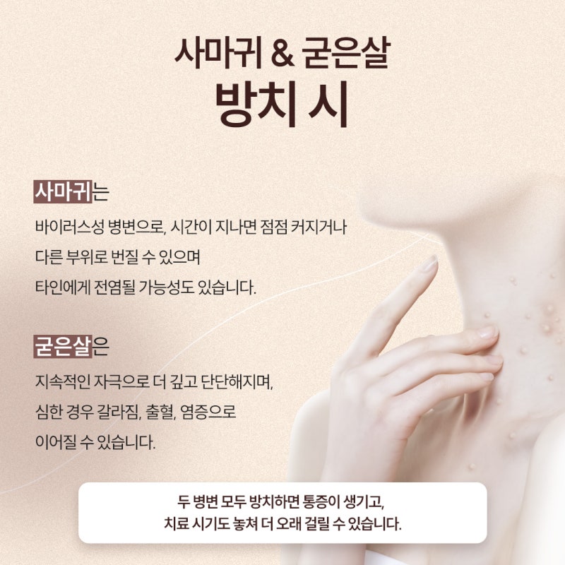 반포사마귀치료, 초기에 정확히 관리해야 하는 이유 사진 4