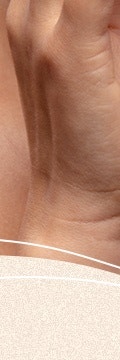 반포사마귀치료, 초기에 정확히 관리해야 하는 이유 사진 18