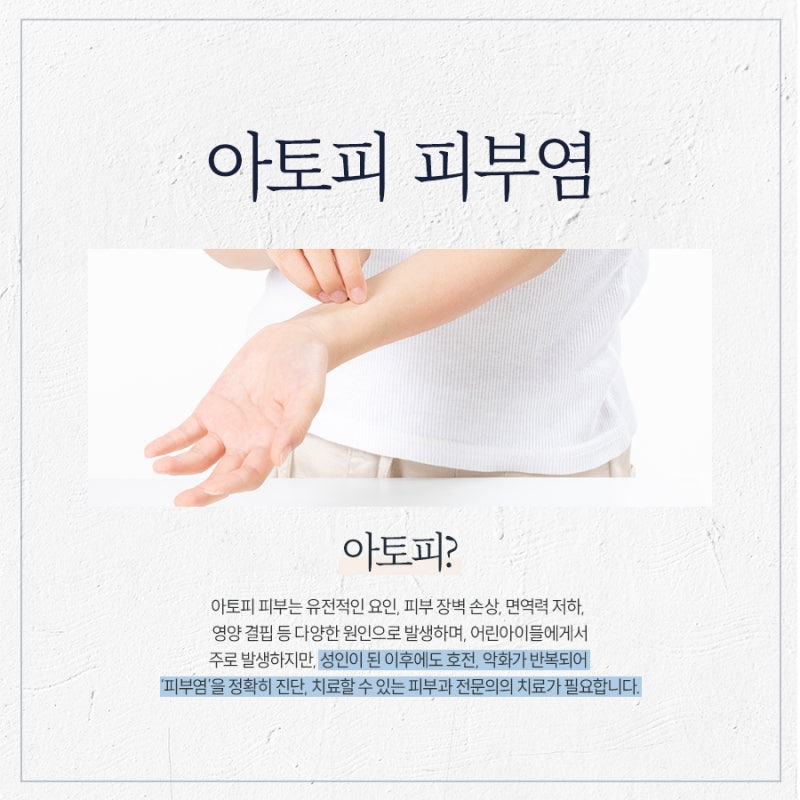 끊이지 않는 가려움, 고속터미널아토피 제대로 관리하려면