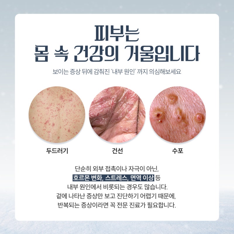 반포동피부질환, 단순 트러블로 넘기면 안 되는 이유