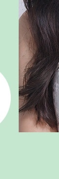 자연스러운 얼굴 탄력 회복, 고속터미널역울트라콜 사진 29