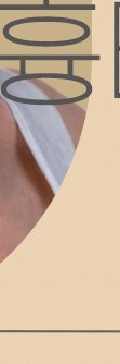 서초흉터치료, 다양한 흉터 유형 사진 31