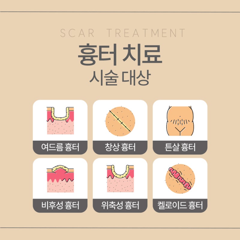 서초흉터치료, 다양한 흉터 유형 사진 4