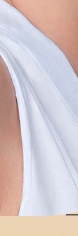 서초흉터치료, 다양한 흉터 유형 사진 29