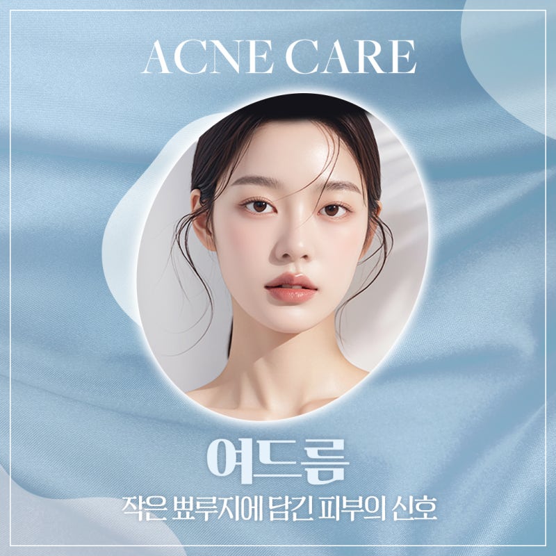 반포여드름치료, 좁쌀부터 염증성까지! 반복되는 여드름 벗어나기 사진 2