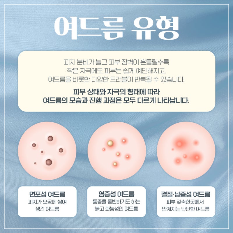 반포여드름치료, 좁쌀부터 염증성까지! 반복되는 여드름 벗어나기 사진 4