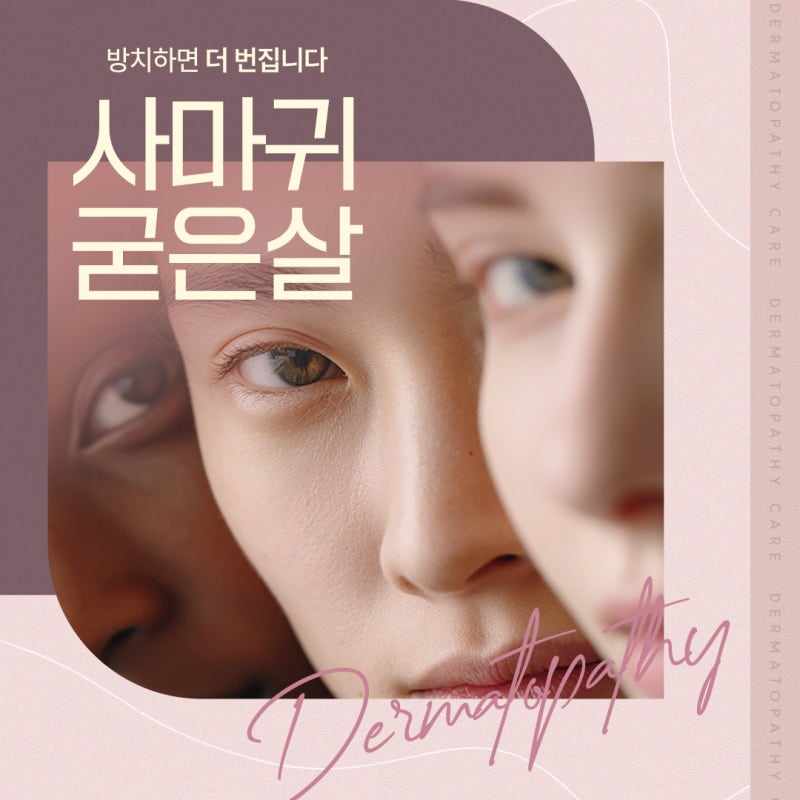 굳은살인 줄 알았는데… 고속터미널역사마귀 의심해야 하는 이유 사진 2