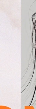 반포역리프팅, 부담은 줄이고 탄력은 채우는 온다리프팅 사진 17