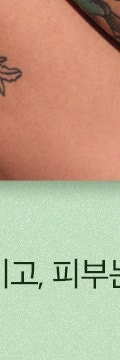 남기긴 쉬워도 지우긴 어려운, 방배동문신제거 사진 29