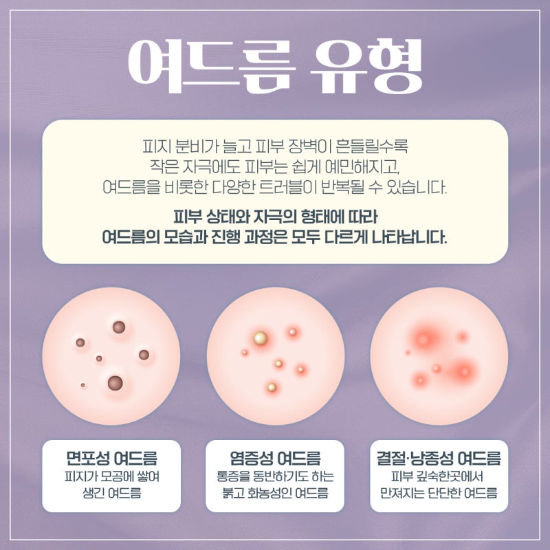 신반포역여드름, 올바른 관리 습관