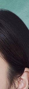 하얀 반점이 고민이라면? 고속터미널역백반증 사진 12