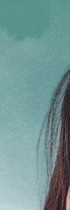 하얀 반점이 고민이라면? 고속터미널역백반증 사진 9